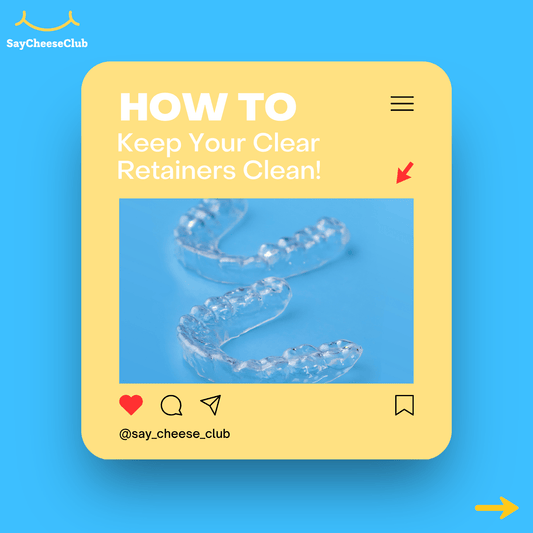 Graphic post titled ‘How To Keep Your Clear Retainers Clean!’ with an image of two transparent dental retainers on a blue background. The design is in a yellow card style with Instagram-style icons and the handle @say_cheese_club displayed at the bottom.