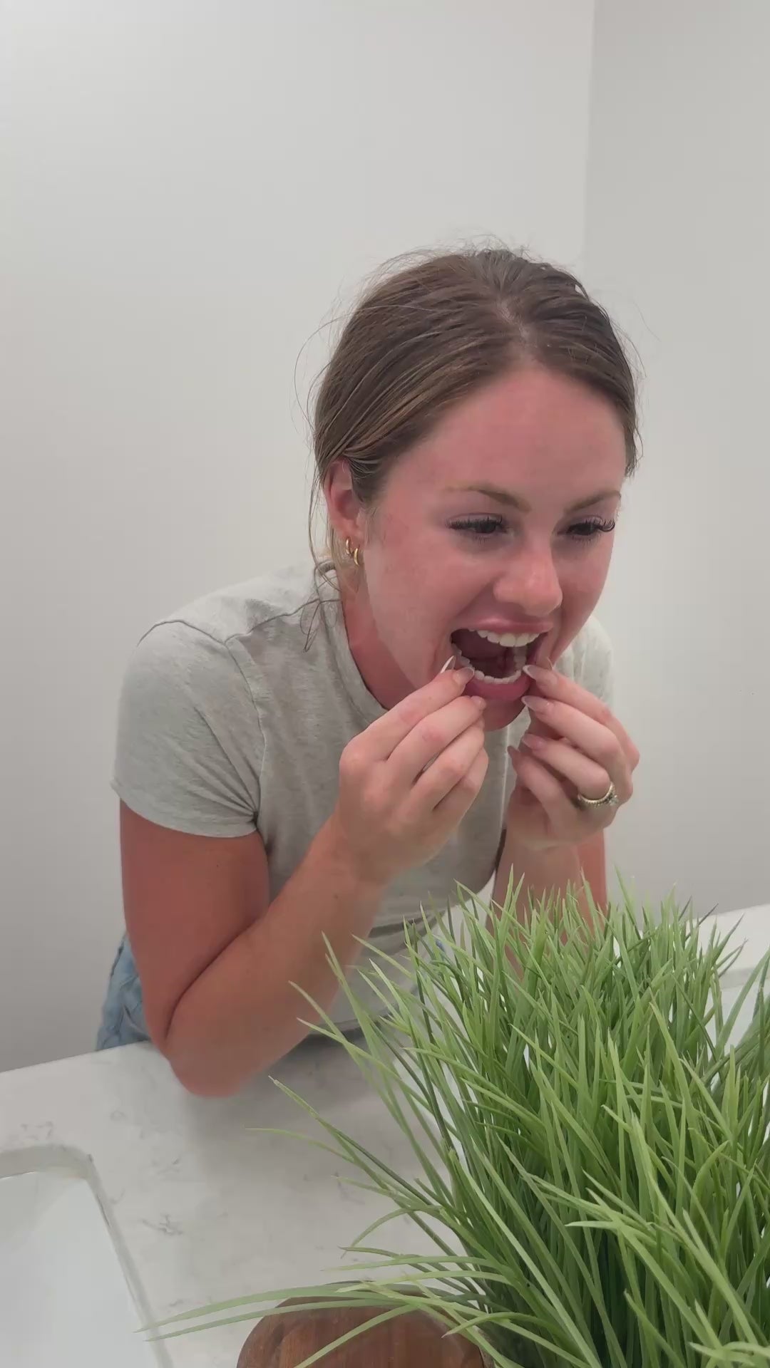 Clear retainer video